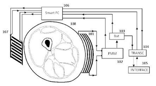 Ein autonomes medizinisches Gerät mit einem Reibungsgenerator zur Elektrotherapie. Ein autonomes medizinisches Gerät mit einem Reibungsgenerator zur Elektrotherapie.