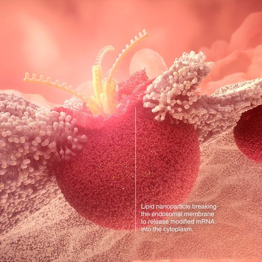 Lipid nanoparticle breaking the endosomal membrane to release modified mRNA into the cytoplasm. Lipid nanoparticle breaking the endosomal membrane to release modified mRNA into the cytoplasm.