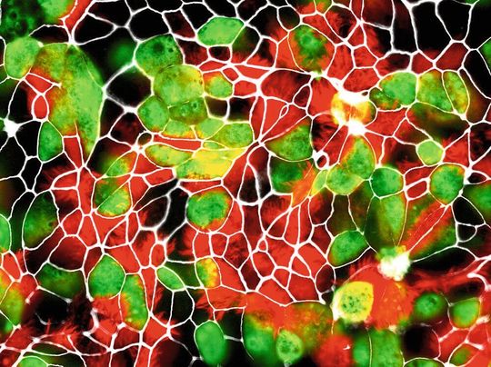 Großaufnahme von AEC-Kulturen von Rhesusaffen mit von SARS-CoV-2 infizierten Zellen (grün). Großaufnahme von AEC-Kulturen von Rhesusaffen mit von SARS-CoV-2 infizierten Zellen (grün).