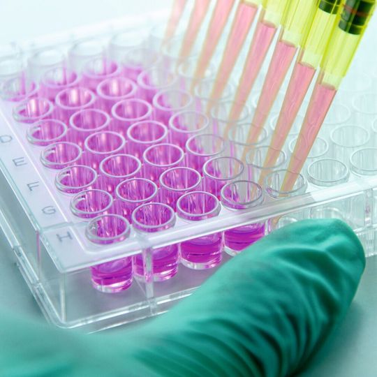 Zellkulturplatten sind in der Biomedizin unverzichtbar, um Zellkulturen zu züchten oder organische Tests außerhalb eines lebenden Organismus durchführen zu können. Zellkulturplatten sind in der Biomedizin unverzichtbar, um Zellkulturen zu züchten oder organische Tests außerhalb eines lebenden Organismus durchführen zu können.