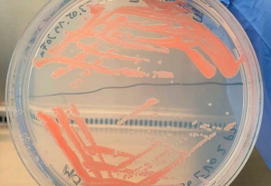 Jetzt wird aus dem Klimaschädling CO2 einfach Kunststoff gemacht! Denn Mikroorganismen, hier im Bild, bei der Umwandlungsarbeit, stellen aus den Zwischenprodukten Methanol und Ameisensäure Polymer-Bausteine her, wie Forschende am Fraunhofer-IGB zeigen können. Jetzt wird aus dem Klimaschädling CO2 einfach Kunststoff gemacht! Denn Mikroorganismen, hier im Bild, bei der Umwandlungsarbeit, stellen aus den Zwischenprodukten Methanol und Ameisensäure Polymer-Bausteine her, wie Forschende am Fraunhofer-IGB zeigen können.