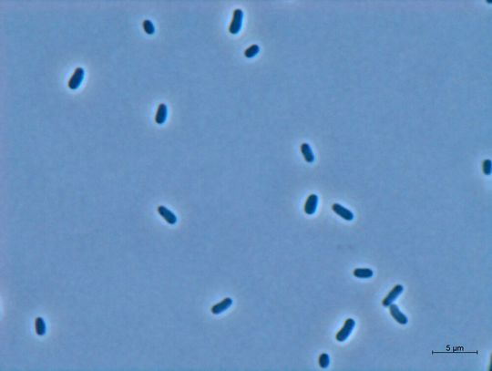 Das ist der winzige Rohstoff-Produzent! Das gram-negative Bakterium Methylobrum extorquens AM1.
