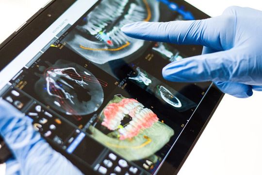 Dentists and dental technicians who use CNC machines powered by Module Works can maximise the efficiency and profitability of their labs and practices through simplified workflows. (symbolic image) Dentists and dental technicians who use CNC machines powered by Module Works can maximise the efficiency and profitability of their labs and practices through simplified workflows. (symbolic image)