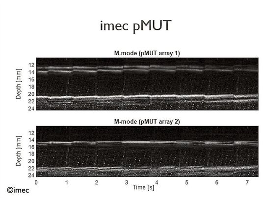 Signalverläufe von zwei piezoelektrischen Mikromechanischen Ultraschallwandlern (pMUT).