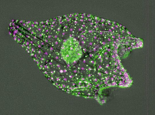 Aufnahme einer Seeigellarve unter dem Fluoreszenzmikroskop. Aufnahme einer Seeigellarve unter dem Fluoreszenzmikroskop.