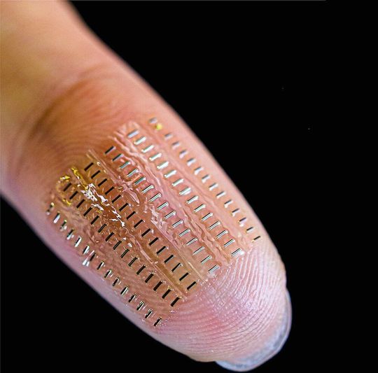 Eine Anordnung von 90 flexiblen und implantierbaren sogenannten Nano-Biosupercapacitors (nBFCs). Diese ermöglichen den autarken Betrieb von Mikrosensorik für den Einsatz unter anderem im Blut. Eine Anordnung von 90 flexiblen und implantierbaren sogenannten Nano-Biosupercapacitors (nBFCs). Diese ermöglichen den autarken Betrieb von Mikrosensorik für den Einsatz unter anderem im Blut.