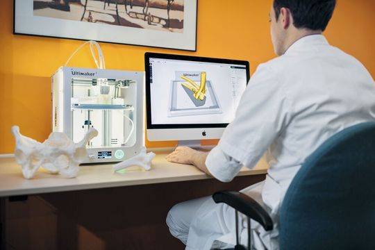 Mit dem 3D-Drucker von Ultimaker können patientenspezifische Modelle und Formen sowie Implantate und Prothesen gedruckt werden. Mit dem 3D-Drucker von Ultimaker können patientenspezifische Modelle und Formen sowie Implantate und Prothesen gedruckt werden.