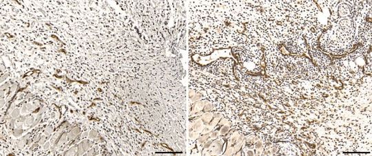 Immunhistochemische Darstellung von Blutgefässen in Hautverletzungen während einer bakteriellen Infektion: Verletzte Hautstellen von Mäusen, denen der Signalfaktor HIF-1α in den Natürlichen Killerzellen fehlt (Bild rechts), weisen eine höhere Gefässdichte auf als normale Mäuse (Bild links). Das führt dazu, dass Bakterien vermehrt aus der Haut in den Blutstrom übertreten.
