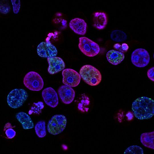 For the first time the process by which cells acquire spatial nonuniformities on their surfaces has been identified. (symbolic image) For the first time the process by which cells acquire spatial nonuniformities on their surfaces has been identified. (symbolic image)