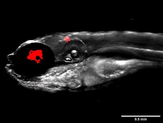 Zebrafish infected with fluorescent bacteria, Mycobacterium abscessus, shown in red. Zebrafish infected with fluorescent bacteria, Mycobacterium abscessus, shown in red.