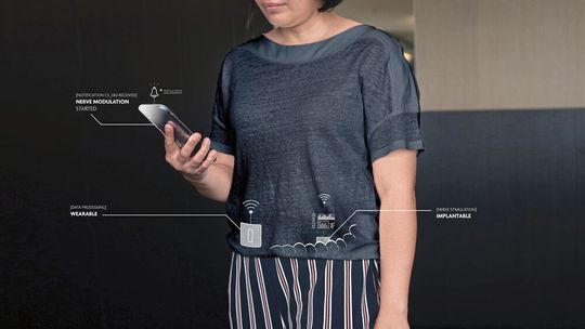 Das implantierbare Neurostimulationsgerät soll kostengünstig sein und so auch Menschen in Entwicklungsländern zugänglich gemacht werden. Das implantierbare Neurostimulationsgerät soll kostengünstig sein und so auch Menschen in Entwicklungsländern zugänglich gemacht werden.