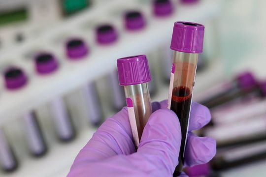 Researchers are developing a deep learning network capable of detecting disease biomarkers with a much higher degree of accuracy. Researchers are developing a deep learning network capable of detecting disease biomarkers with a much higher degree of accuracy.