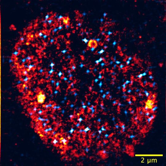 Microscopy of a nucleus: Transcription factories are colored orange, activated genes light blue. The nucleus has about one tenth of the thickness of a human hair. Microscopy of a nucleus: Transcription factories are colored orange, activated genes light blue. The nucleus has about one tenth of the thickness of a human hair.