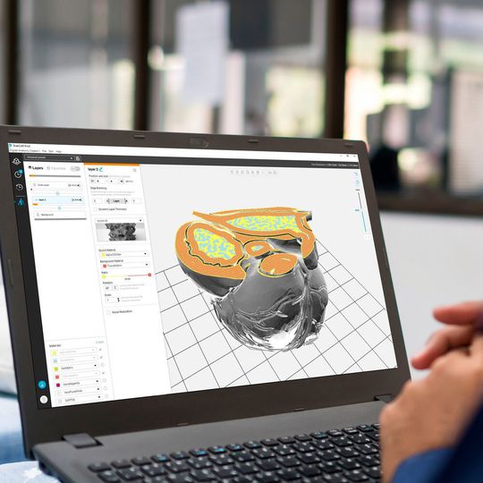 Digital Anatomy Creator bietet völlig neue Möglichkeiten zur Erstellung funktioneller medizinischer Modelle. Digital Anatomy Creator bietet völlig neue Möglichkeiten zur Erstellung funktioneller medizinischer Modelle.