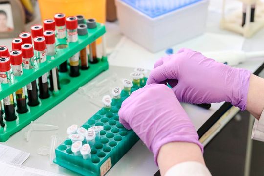 Avantor has announced that it has entered into an agreement to distribute Agilent Technologies products in the United States and Canada. (Symbolic Image) Avantor has announced that it has entered into an agreement to distribute Agilent Technologies products in the United States and Canada. (Symbolic Image)