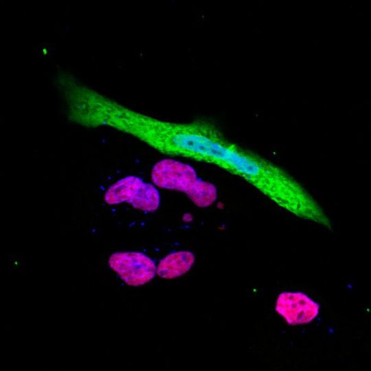 The expression of the immune response gene NLRC5 (red purple) is suppressed in SARS-CoV-2 (green) infected cells. The expression of the immune response gene NLRC5 (red purple) is suppressed in SARS-CoV-2 (green) infected cells.