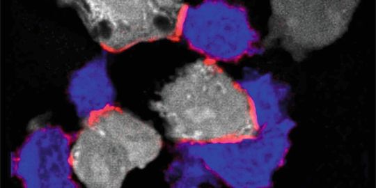 Immunfluoreszenzmikroskopie: T-Zellen (blau) greifen Krebszellen (grau) an, indem sie über ihr Oberflächenprotein LFA-1 an sie binden. LFA-1 braucht Magnesium, um eine aktive, langgestreckte Form einzunehmen (aktives LFA-1 in rot). Immunfluoreszenzmikroskopie: T-Zellen (blau) greifen Krebszellen (grau) an, indem sie über ihr Oberflächenprotein LFA-1 an sie binden. LFA-1 braucht Magnesium, um eine aktive, langgestreckte Form einzunehmen (aktives LFA-1 in rot).