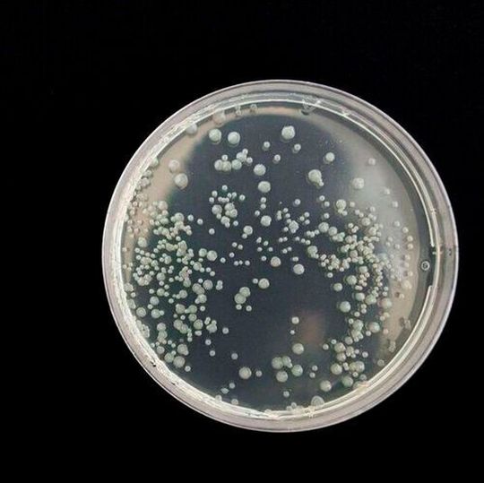 Regular quality control and colony counts during the entire manufacturing process aim to rule out the contamination of the product with micro-organisms such as bacteria, viruses, yeasts, or molds. Regular quality control and colony counts during the entire manufacturing process aim to rule out the contamination of the product with micro-organisms such as bacteria, viruses, yeasts, or molds.