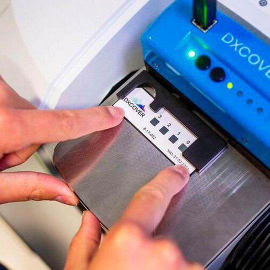 Dxcover's Drop.Dry.Detect. technique and patented hardware is designed specifically for the analysis of biofluids. Dxcover's Drop.Dry.Detect. technique and patented hardware is designed specifically for the analysis of biofluids.