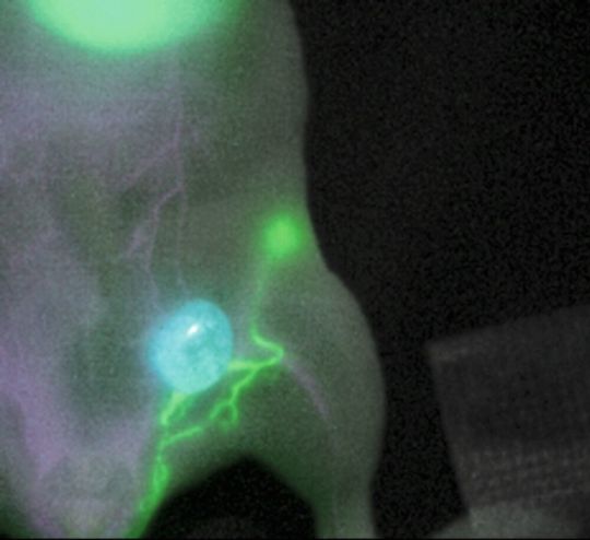 Die neue Fluoreszenbildgebung macht Tumor (blau), Lymphgefäße (grün) und Blutgefäße (magenta) sichtbar. Die neue Fluoreszenbildgebung macht Tumor (blau), Lymphgefäße (grün) und Blutgefäße (magenta) sichtbar.
