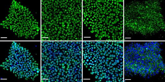 Stem cells in an undifferentiated state. At the top, various pluripotency markers are colored green. In the bottom row, the cell nuclei are additionally visible in blue.