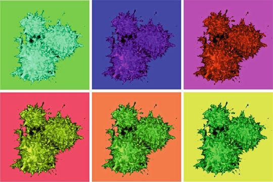ASC-Specks – hier in verschiedenen Farben dargestellt – sind große Komplexe vieler Kopien des ASC-Proteins. Im Gewebe können sie immensen Schaden anrichten. ASC-Specks – hier in verschiedenen Farben dargestellt – sind große Komplexe vieler Kopien des ASC-Proteins. Im Gewebe können sie immensen Schaden anrichten.