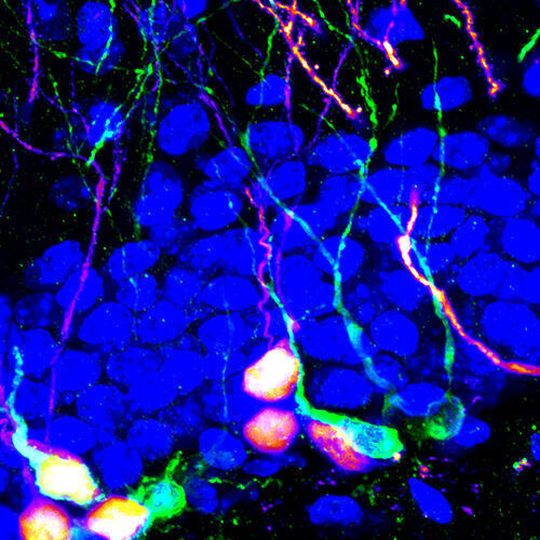 New adult-born neurons that contribute to memory and emotion regulation. New adult-born neurons that contribute to memory and emotion regulation.