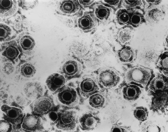 Herpes-Infektion über Textilien?