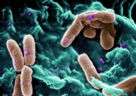 Abb. 1: Bakterium Pseudomonas aeruginosa (braun eingefärbt) unter dem Raster-Scanning-Mikroskop. Abb. 1: Bakterium Pseudomonas aeruginosa (braun eingefärbt) unter dem Raster-Scanning-Mikroskop.