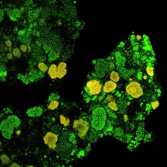 1 Nachweis der Mikrokolonien von Nitrospira (gelb) sowie anderer Bakterien (grün) in Klärschlamm mittels Fluoreszenz-in-situ-Hybridisierung (Bilder: Universität Wien, Department für mikrobielle Ökologie). 1 Nachweis der Mikrokolonien von Nitrospira (gelb) sowie anderer Bakterien (grün) in Klärschlamm mittels Fluoreszenz-in-situ-Hybridisierung (Bilder: Universität Wien, Department für mikrobielle Ökologie).