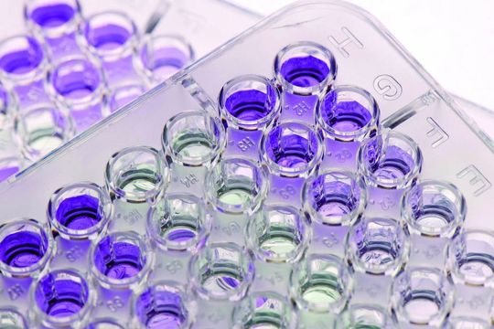 1 Fluoreszenzassay für die photometrische Bestimmung der Enzymaktivität von Nanopartikel-Enzym-Konjugaten. (Bilder: Fraunhofer IGB) 1 Fluoreszenzassay für die photometrische Bestimmung der Enzymaktivität von Nanopartikel-Enzym-Konjugaten. (Bilder: Fraunhofer IGB)