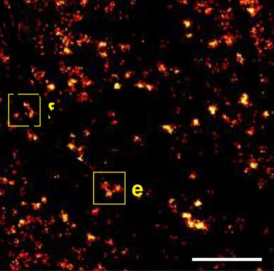 Mit Fluoreszenz-Farbstoffen markierte 2B-Histone im Kern einer lebenden Zelle: Oben ein Ausschnitt aus einer superaufgelösten Aufnahme, erstellt aus 10 000 Einzelaufnahmen mit der Methode dSTORM ... (Bilder: Arbeitsgruppe Markus Sauer, Biozentrum Uni Würzburg) Mit Fluoreszenz-Farbstoffen markierte 2B-Histone im Kern einer lebenden Zelle: Oben ein Ausschnitt aus einer superaufgelösten Aufnahme, erstellt aus 10 000 Einzelaufnahmen mit der Methode dSTORM ... (Bilder: Arbeitsgruppe Markus Sauer, Biozentrum Uni Würzburg)