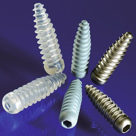 Nach dem Mikro-Metallpulver-Spritzgussverfahren hergestellte Interferenzschrauben; außer verschiedenen Metallen und Metalllegierungen, wie Titan oder Titanlegierungen, können auch Keramiken und Kunststoffe verarbeitet werden. Bild: IFAM Nach dem Mikro-Metallpulver-Spritzgussverfahren hergestellte Interferenzschrauben; außer verschiedenen Metallen und Metalllegierungen, wie Titan oder Titanlegierungen, können auch Keramiken und Kunststoffe verarbeitet werden. Bild: IFAM