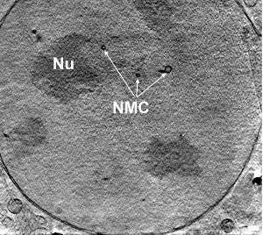 Der 3-D-Schnitt durch den Kern einer Adenokarzinom-Zelle einer Maus zeigt den Nukleolus (NU) und die quer durch den Kern verlaufenden Membrankanäle (NMC) mittels Röntgen-Nanotomographie. Der 3-D-Schnitt durch den Kern einer Adenokarzinom-Zelle einer Maus zeigt den Nukleolus (NU) und die quer durch den Kern verlaufenden Membrankanäle (NMC) mittels Röntgen-Nanotomographie.