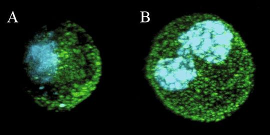 Abb. 1: Segregation des Numb Proteins während der Zellteilung in Brust-Stammzellen – normale Brust- (A) und Krebs-Stammzellen (B) . (Bild: IFOM-IEO) Abb. 1: Segregation des Numb Proteins während der Zellteilung in Brust-Stammzellen – normale Brust- (A) und Krebs-Stammzellen (B) . (Bild: IFOM-IEO)