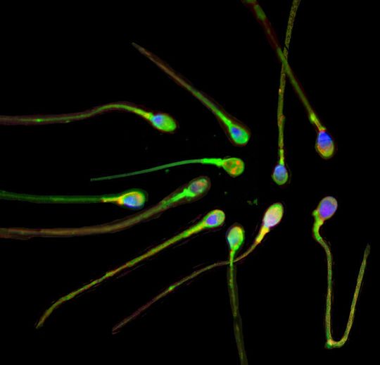 Für die Fertilität von Spermien spielen Kalziumionen eine entscheidende Rolle. (Bild: Ruhr-Universität Bochum) Für die Fertilität von Spermien spielen Kalziumionen eine entscheidende Rolle. (Bild: Ruhr-Universität Bochum)