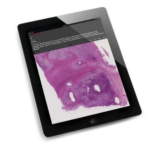 Mit Slide Path Gateway für das iPad steht die Digitale Pathologie auf Tastendruck zur Verfügung. (Bild: Leica) Mit Slide Path Gateway für das iPad steht die Digitale Pathologie auf Tastendruck zur Verfügung. (Bild: Leica)