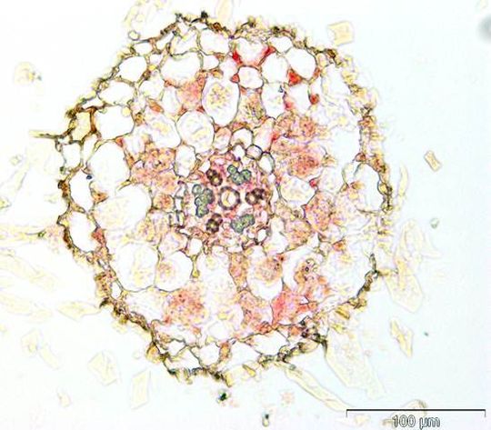 Querschnitt durch eine mykorrhizierte Wurzel vom Schneckenhornklee. Die roten Stellen zeigen Anhäufungen der microRNA in und um Pilz-besiedelte Zellen. (Bild: MPI für molekulare Pflanzenphysiologie) Querschnitt durch eine mykorrhizierte Wurzel vom Schneckenhornklee. Die roten Stellen zeigen Anhäufungen der microRNA in und um Pilz-besiedelte Zellen. (Bild: MPI für molekulare Pflanzenphysiologie)