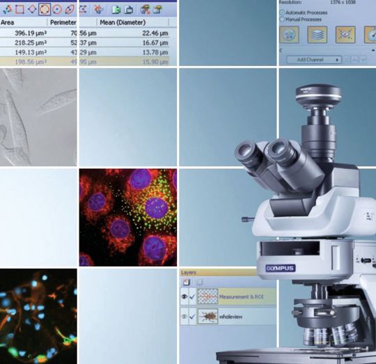 Abb. 1: Mit dem neuen Software-Modul Cellsens Multi-Position Solution lassen sich auch großflächige Proben präzise und automatisch analysieren. (Bild: Olympus) Abb. 1: Mit dem neuen Software-Modul Cellsens Multi-Position Solution lassen sich auch großflächige Proben präzise und automatisch analysieren. (Bild: Olympus)