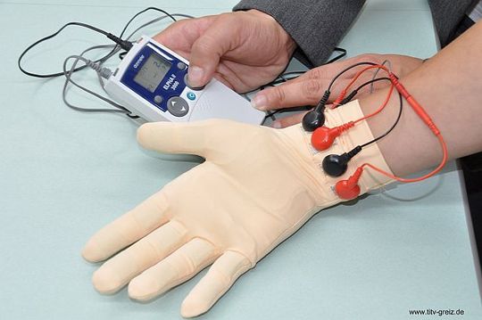 Bald am Start: Therapiehandschuh mit gestickten Fingerelektroden (Foto: TITV)