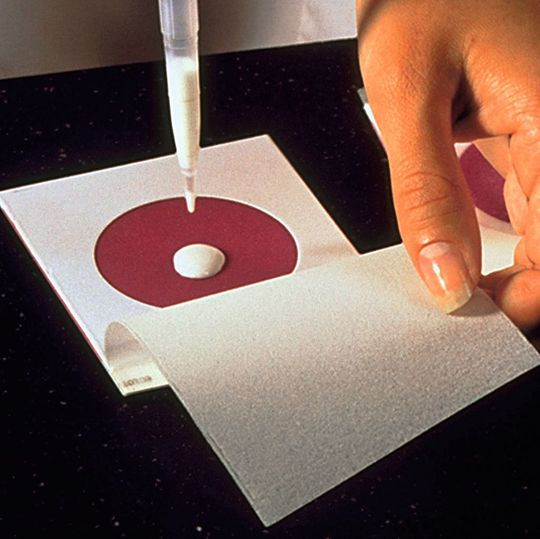 Die Inokulatione eines 3M Petrifilms. (Bild: 3M) Die Inokulatione eines 3M Petrifilms. (Bild: 3M)
