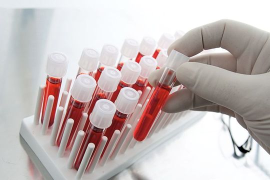 Abb. 1: Die DIN EN ISO 15189 wird durch Akkreditierungsstellen bei der Bestätigung oder Anerkennung der Kompetenz von medizinischen Laboratorien herangezogen. (Bild: Fotolia/Mario Beauregard) Abb. 1: Die DIN EN ISO 15189 wird durch Akkreditierungsstellen bei der Bestätigung oder Anerkennung der Kompetenz von medizinischen Laboratorien herangezogen. (Bild: Fotolia/Mario Beauregard)