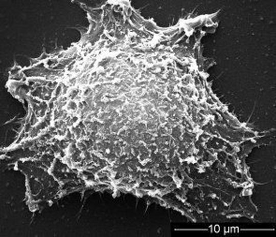 Entsprechend vorbehandelte Goldnanostäbchen können eine effektive photothermische Tumorbehandlung ermöglichen. (Quelle: Wiley-VCH) Entsprechend vorbehandelte Goldnanostäbchen können eine effektive photothermische Tumorbehandlung ermöglichen. (Quelle: Wiley-VCH)
