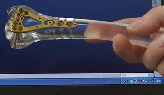 Die *SMTI 2011"- Studie zeigt den aktuellen Stand der Schweizer Medizintechnik-Branche auf und erläutert, in welchen Bereichen Handlungsbedarf besteht. (Bild: Medtech Switzerland) Die *SMTI 2011"- Studie zeigt den aktuellen Stand der Schweizer Medizintechnik-Branche auf und erläutert, in welchen Bereichen Handlungsbedarf besteht. (Bild: Medtech Switzerland)