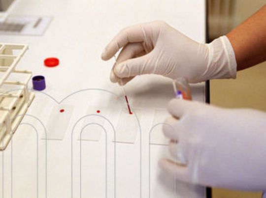 Mithilfe von Bluttests kann u.a. das Cholsterin analysiert werden. (Bild: Medizinische Universität Wien) Mithilfe von Bluttests kann u.a. das Cholsterin analysiert werden. (Bild: Medizinische Universität Wien)