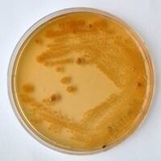 E-Coli-Kultur in einer Petrischale E-Coli-Kultur in einer Petrischale