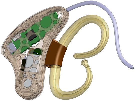 Der erste für klinische Studien entwickelte und geprüfte Prototyp des neuen oesophagealen EKG-Recorders im Entwurfsprozess… Der erste für klinische Studien entwickelte und geprüfte Prototyp des neuen oesophagealen EKG-Recorders im Entwurfsprozess…