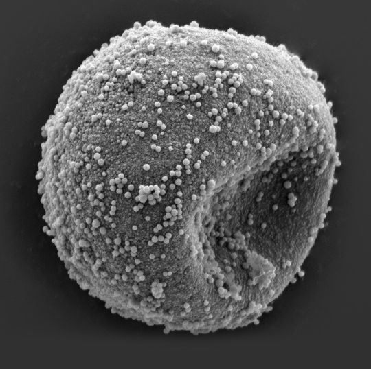 Abb. 1: Wacholder-Pollen Abb. 1: Wacholder-Pollen