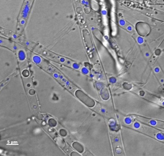 Abb. 1: Mikroskopische Aufnahme des Myzel-bildenden Boden Mikroorganimus Pythium ultimum welcher Phenanthren in seinem Zellinnern transportiert: Overlay eines Durchlicht- und Fluoreszenzbildes von Pythium ultimum, dessen Hyphen Phenanthren-angereicherte Vesikel (in blau) enthalten. Abb. 1: Mikroskopische Aufnahme des Myzel-bildenden Boden Mikroorganimus Pythium ultimum welcher Phenanthren in seinem Zellinnern transportiert: Overlay eines Durchlicht- und Fluoreszenzbildes von Pythium ultimum, dessen Hyphen Phenanthren-angereicherte Vesikel (in blau) enthalten.
