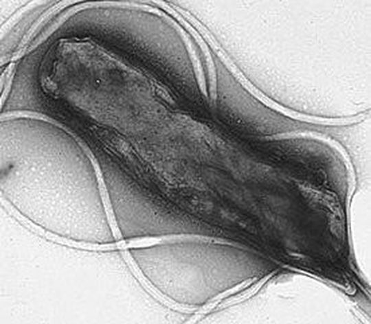 Helicobacter pylori ist ein Bakterium, das sich beim Menschen im Magen einnistet. Helicobacter pylori ist ein Bakterium, das sich beim Menschen im Magen einnistet.